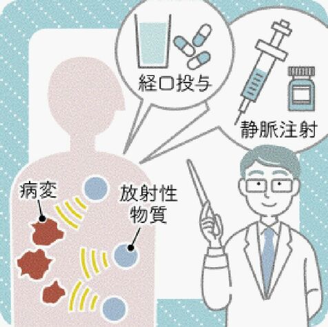 放射線治療の二つの手法　琉球大学病院の移転で増える専用室　アイソトープ治療の拡充へ準備